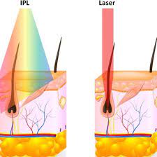 Diodenlaser